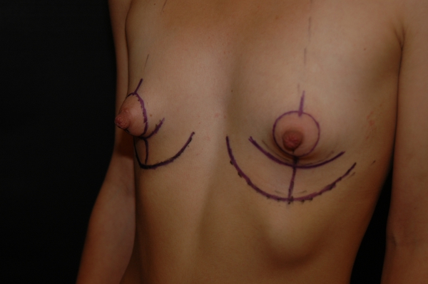 DSC 0031