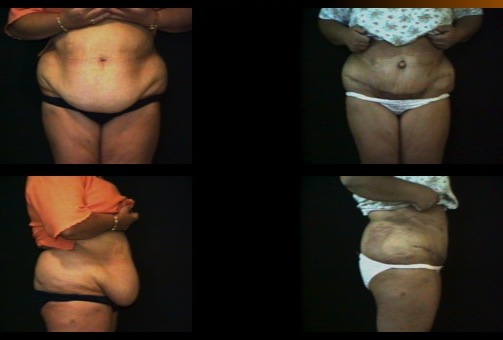 Slide31
