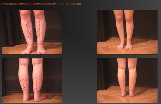 Slide32